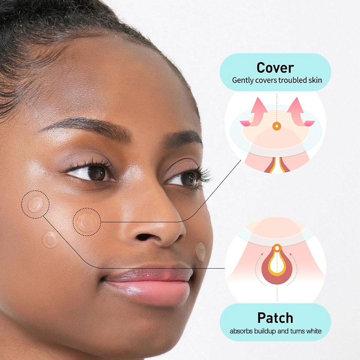 Parches para Cubrir Manchas Ol - Skincare Moisturizer reseña y precio