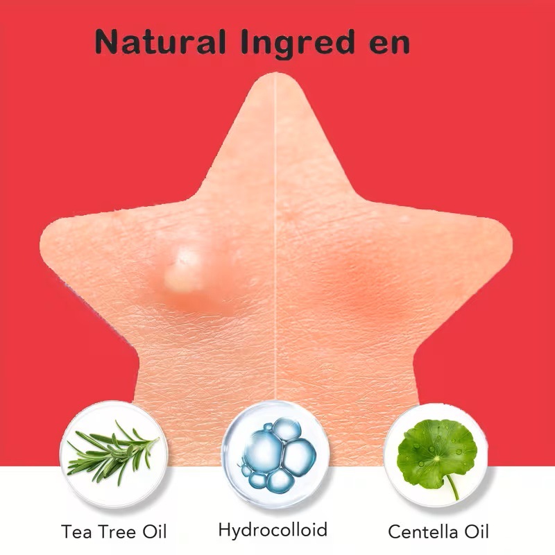 200/400 Parches para Acné de T - Skincare Moisturizer reseña y precio