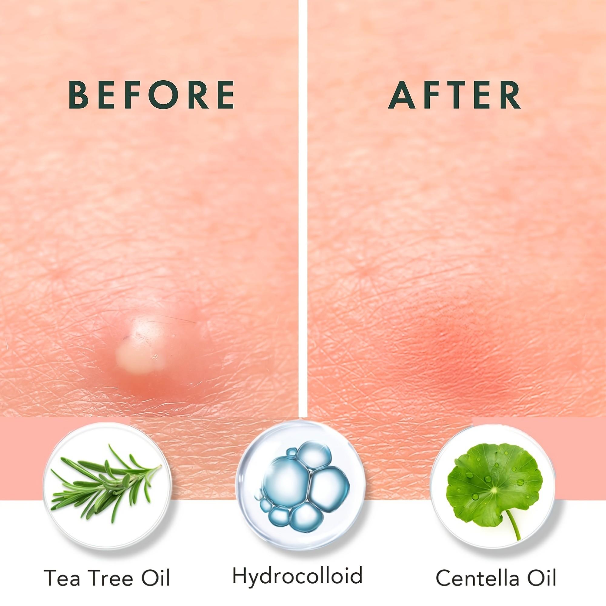 180/360/720 parches para el ac - Skincare Moisturizer reseña y precio